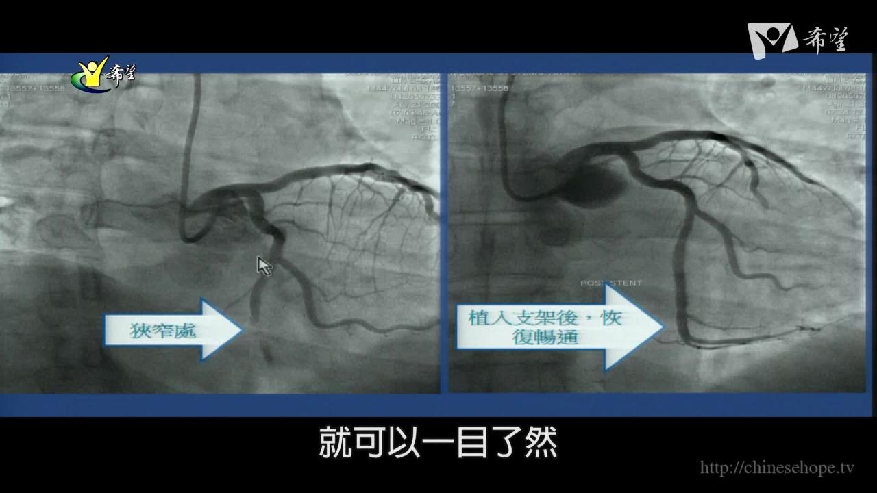 267. 心導管                                                                                            